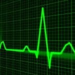 El Apple Heart Study identifica ritmo cardíaco irregular en 2.000 pacientes